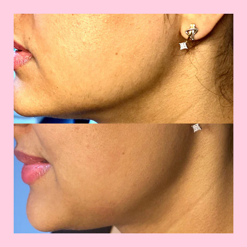 Facial Trimmer