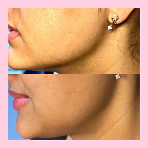 Facial Trimmer